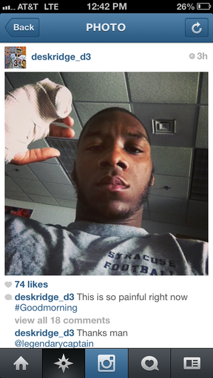 Syracuse safety Durell Eskridge posted a photo on his Instagram account of his right hand in a cast. 